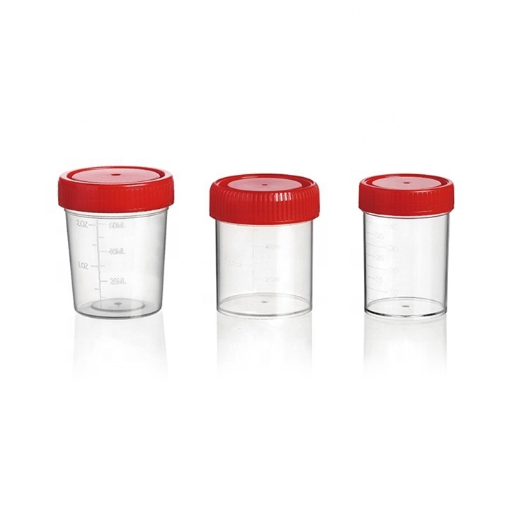 Specimen Containers — Disposable Supplies supplied by Philmed Supplies Inc.